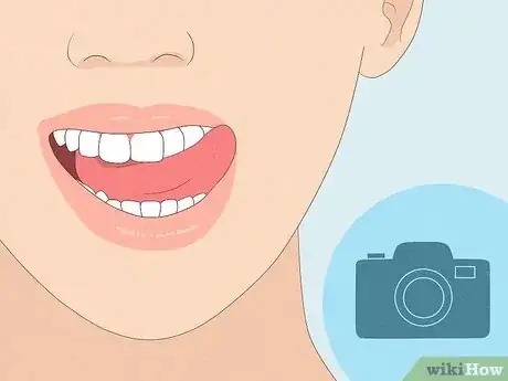 Image titled Have the Perfect Smile Step 3