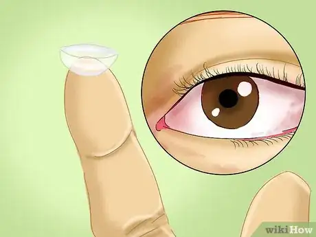 Image titled Determine if You Are Overwearing Your Contact Lenses Step 9