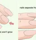 Strengthen Weak Fingernails Naturally