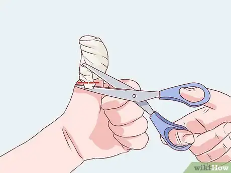 Image titled Bandage Fingers or Toes Step 15