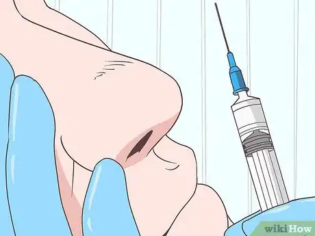 Image titled Get Rid of Spider Veins on Your Nose Step 11