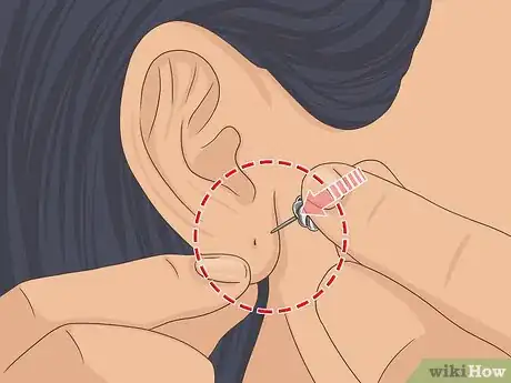 Image titled Put Your Earring Back when It Won't Go in Step 5