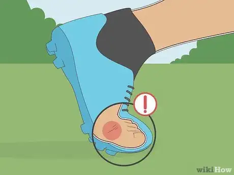 Image titled Treat Soccer Toe Step 13