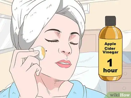 Image titled Remove Moles Without Surgery Step 13