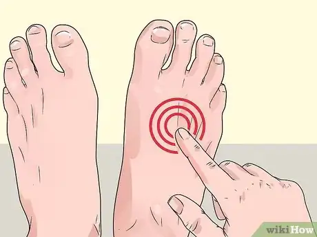 Image titled Check Feet for Complications of Diabetes Step 3