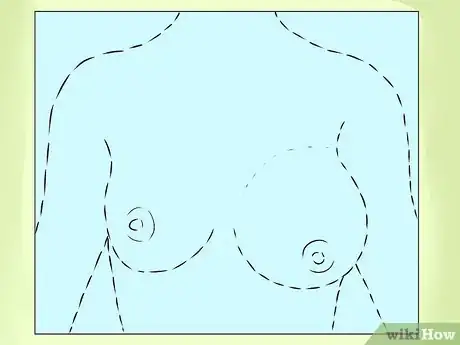 Image titled Know if You Have Breast Cancer Step 7