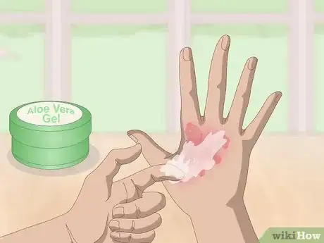 Image titled Get Rid of Scars Step 16