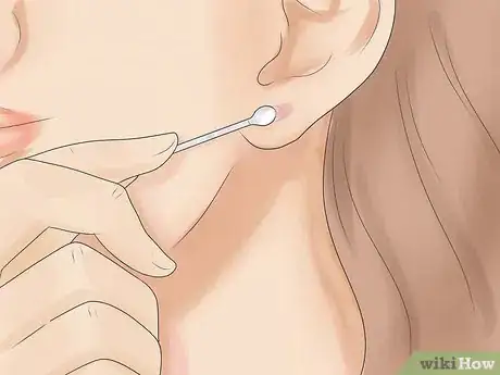 Image titled Take Care of Infection in Newly Pierced Ears Step 5