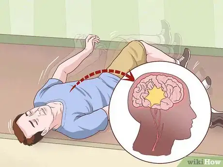 Image titled Diagnose Frontal Lobe Seizure Step 8