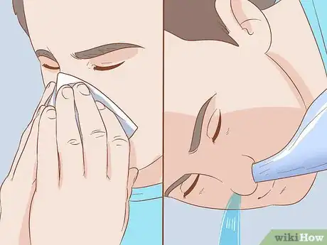 Image titled Stop a Runny Nose Without Medicine Step 6