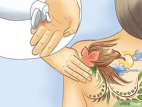 Image titled Get Rid of Tattoo Scarring and Blowouts Step 7
