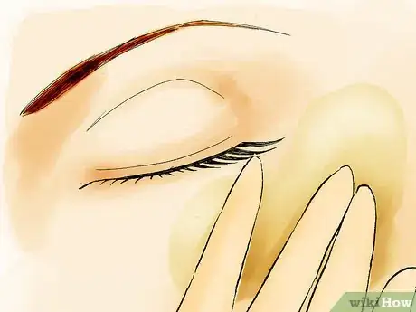 Image titled Quickly Get Rid of Bags Under Your Eyes Step 15