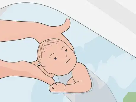 Image titled Care for a Circumcized Baby Step 4