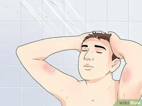 Image titled Get Rid of Eczema and Staph Step 8
