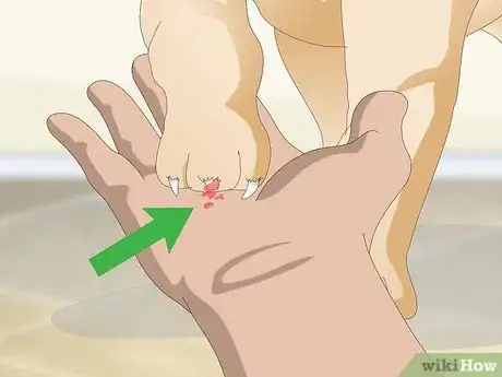Image titled Stop a Quick from Bleeding Step 13