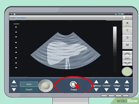 Image titled Use an Ultrasound Transducer Step 7