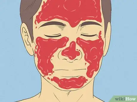 Image titled Make a Cleanser for Oily Skin Step 13