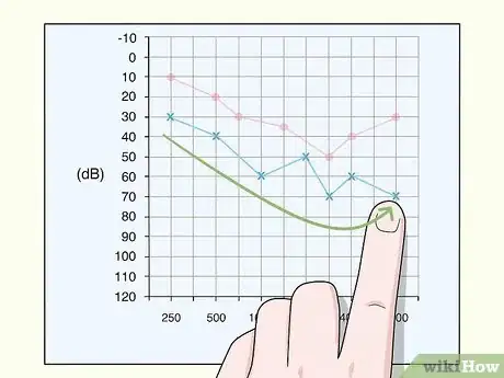 Image titled Read an Audiogram Step 12