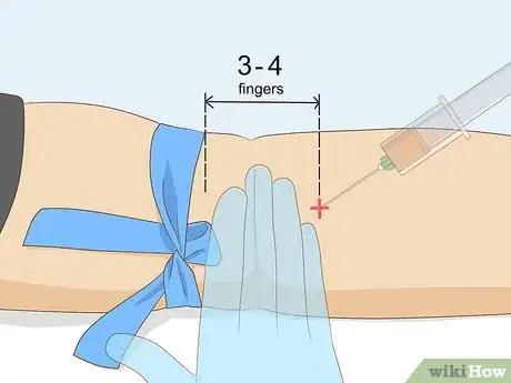 Image titled Troubleshoot a Difficult Venipuncture Step 10