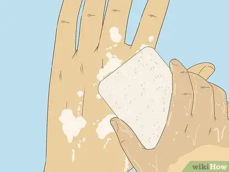 Image titled Get Spray Foam Off Hands Step 6