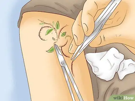 Image titled Get Rid of Tattoo Scarring and Blowouts Step 9