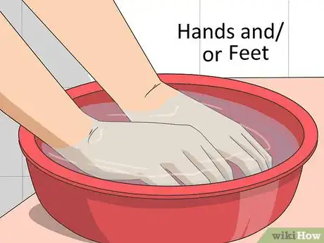 Image titled Treat Calluses on Your Hands and Feet Step 2