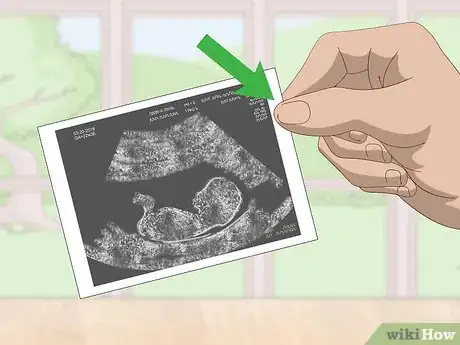 Image titled Store Ultrasound Photos Step 1