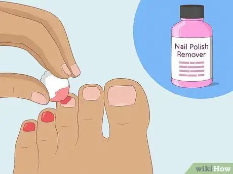 Image titled Do a French Pedicure Step 1