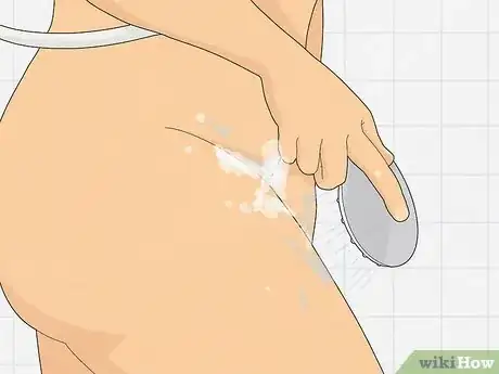 Image titled Get Rid of a UTI Without Medication Step 4
