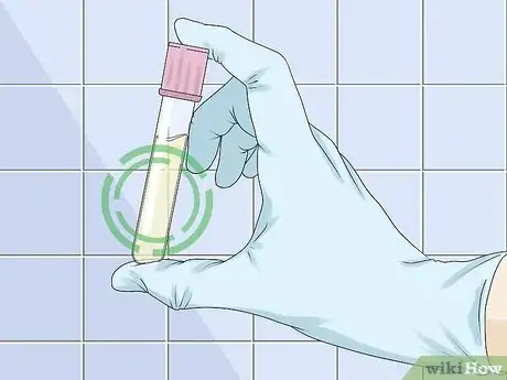 Image titled Use a Urine Dipstick Test Step 11