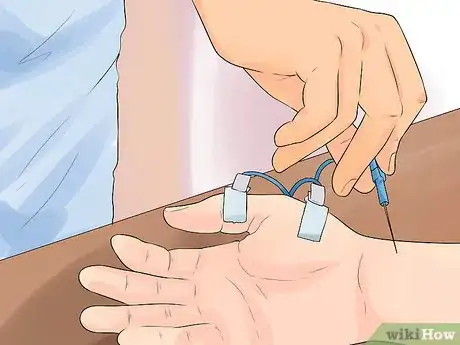 Image titled Diagnose Carpal Tunnel Syndrome Step 11