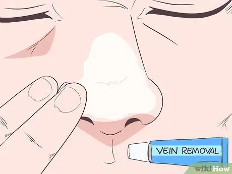 Image titled Get Rid of Spider Veins on Your Nose Step 6