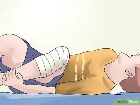 Image titled Treat a Closed Fracture During First Aid Step 12