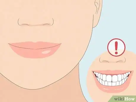 Image titled Have the Perfect Smile Step 2