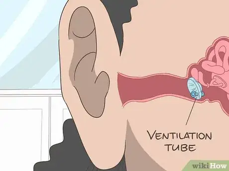 Image titled Unclog Your Ears After a Cold Step 15