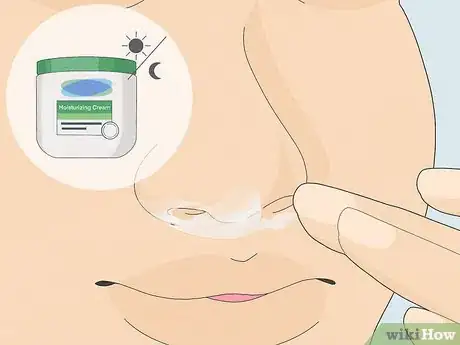 Image titled Get Rid of Dry Skin Under Your Nose Step 6