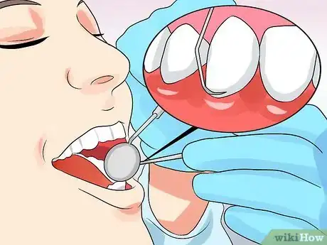 Image titled Soothe Red and Inflamed Gums Step 12