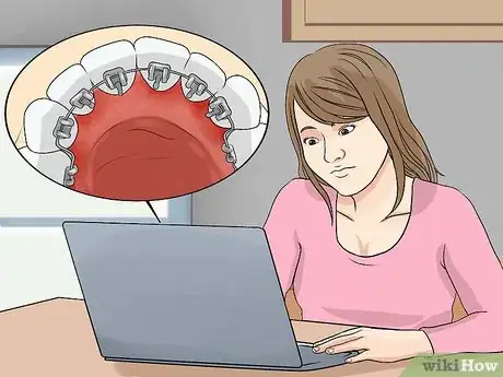 Image titled Prepare for the Day That You Get Braces Step 3