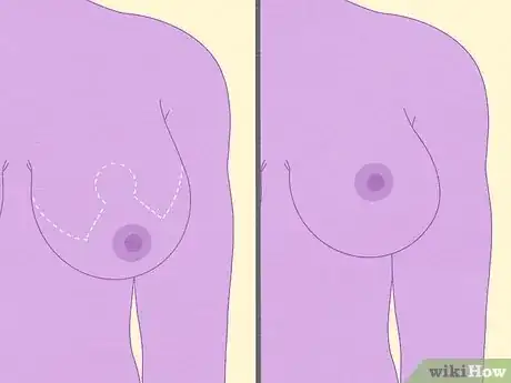 Image titled Reduce Your Bust Step 16