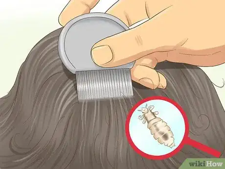 Image titled Check a Child's Hair for Lice Step 5