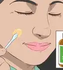 Remove Moles Without Surgery
