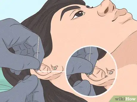 Image titled Is It Safe to Pierce Your Own Cartilage Step 30