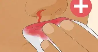 Know if You Have Internal Bleeding