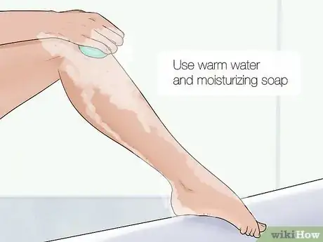 Image titled Remove an Ingrown Hair Step 8