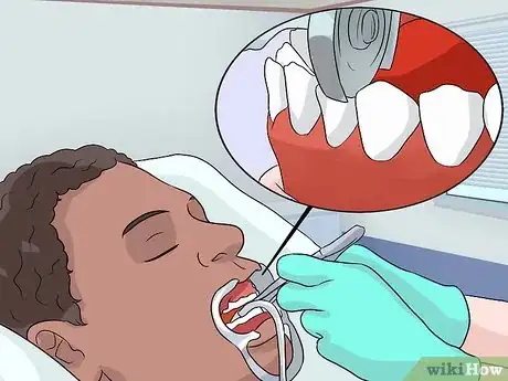 Image titled Stop a Mouth Ulcer from Hurting Step 23