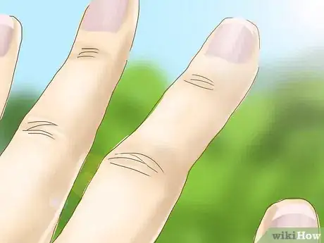 Image titled Get Rid of Yellow Nails Step 11