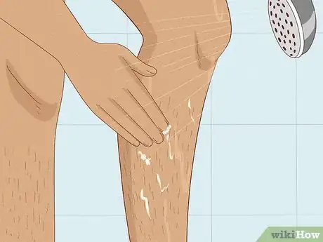 Image titled Prevent Ingrown Hairs After Waxing Using Home Remedies Step 5