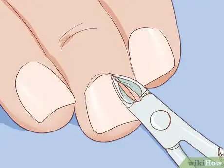 Image titled Clean Cuticles Step 5