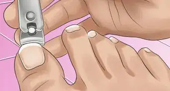Clean Toe Nails