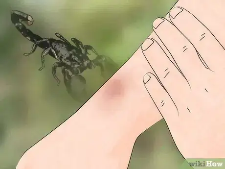 Image titled Identify a Spider Bite Step 6
